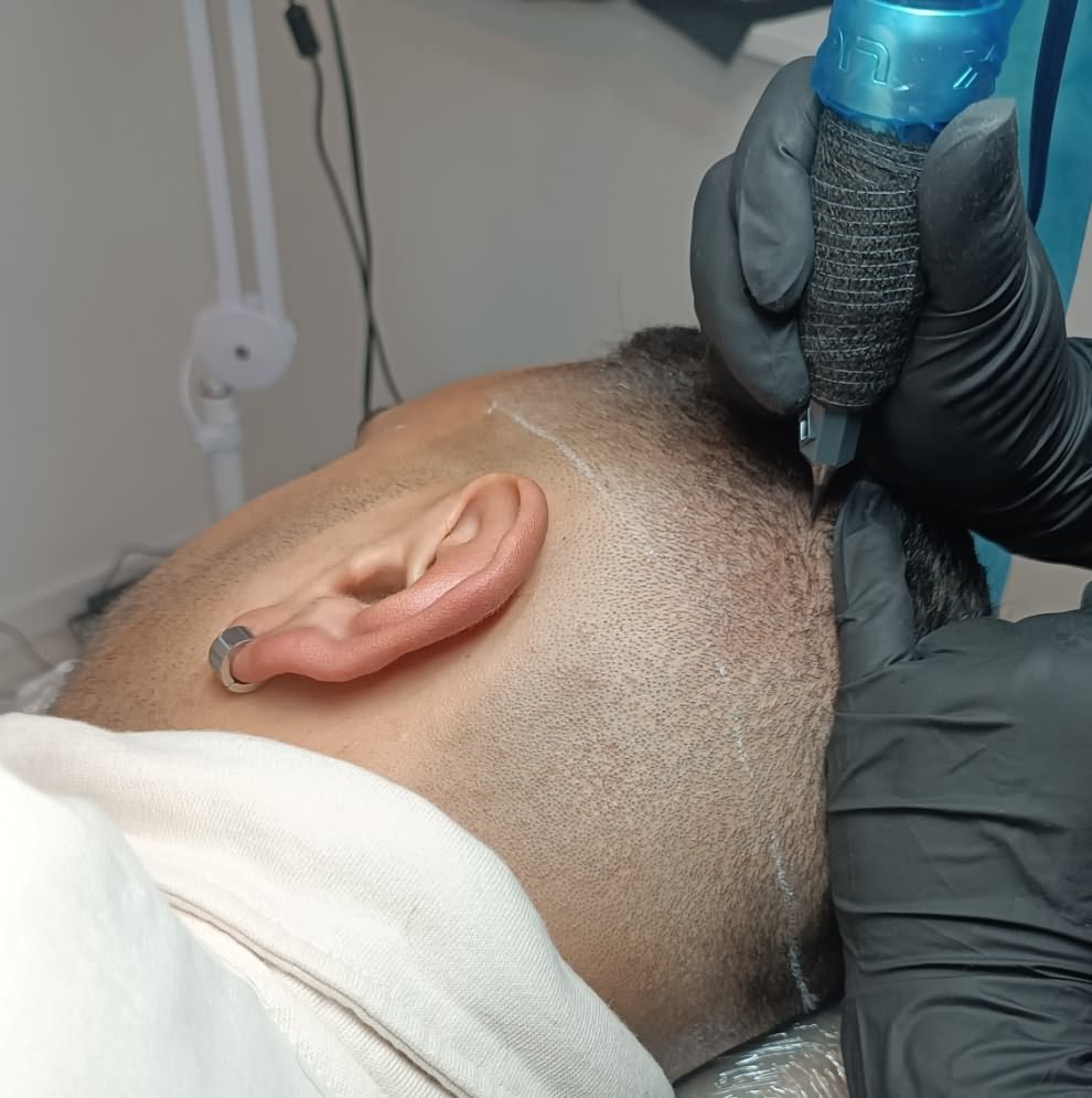 SMP Behandlung Ergebnis